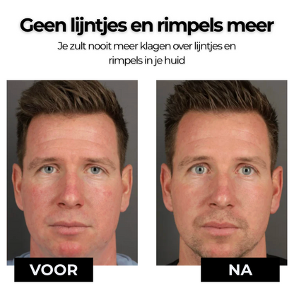 BioTallow Rimpelbescherming Balsem