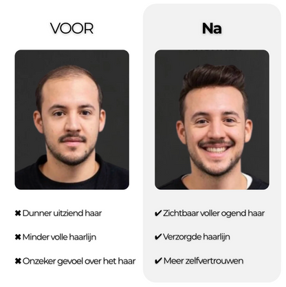 Follica Haarolie Ondersteunt een gezonde haargroei
