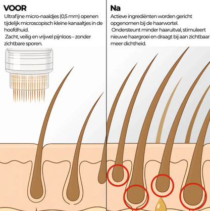 Densiva Hair Restore - Compleet Haarherstel Systeem