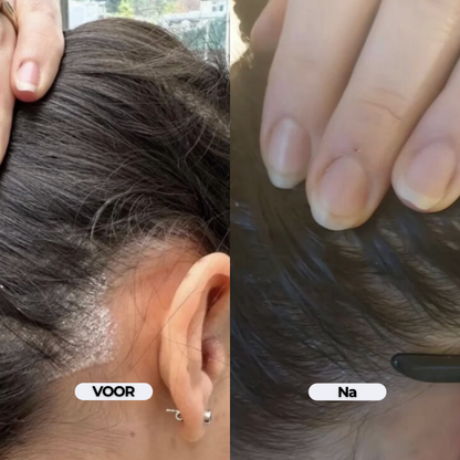 DermaCalm Repair - Kalmerende verzorging bij jeuk en schilfers op de hoofdhuid