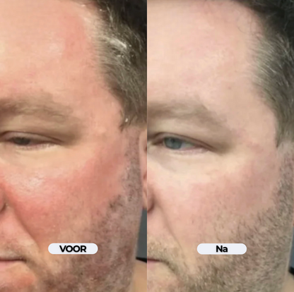 DermaCalm Repair - Kalmerende verzorging bij jeuk en schilfers op de hoofdhuid