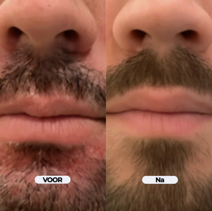 DermaCalm Repair - Kalmerende verzorging bij jeuk en schilfers op de hoofdhuid